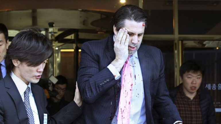 Εξιτήριο από το νοσοκομείο πήρε ο Λίπερτ